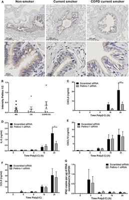 Pellino-1 Regulates the Responses of the Airway to Viral Infection